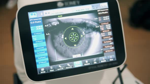 Display with an Eye During the Checkup on It