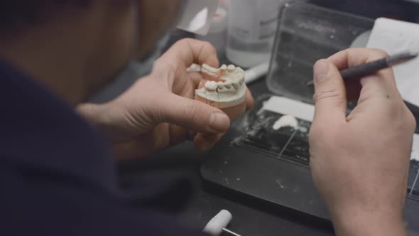 A Dentist Creates a Model of a Jaw Prosthesis and Ceramic Teeth in the Laboratory