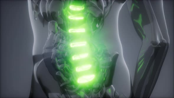 Backache in Back Bones alt