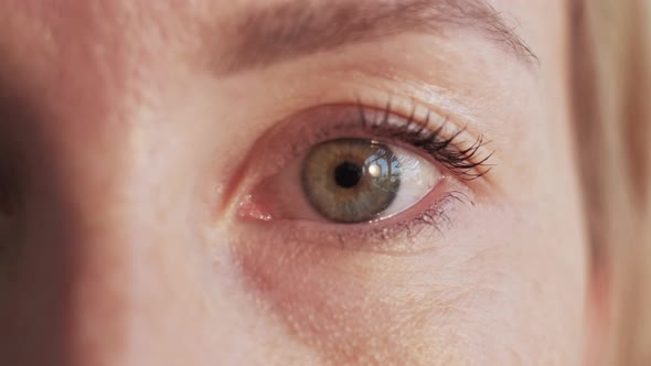 Female Sight Ophthalmology Problem Health Care