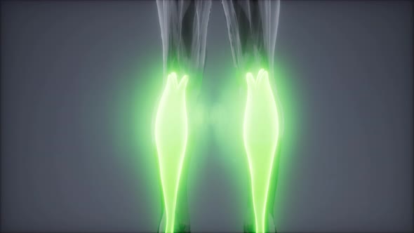 Gastrocnemius- Visible Muscle Anatomy Map