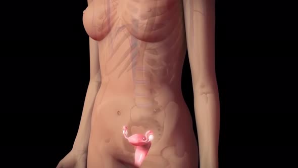 Uterus with endometriosis animation. Fertility, human anatomy, female reproductive system.