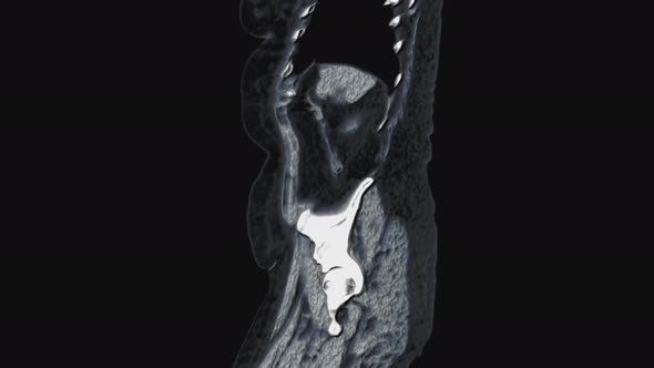 Voluminous Color MRI of the Abdominal Cavity, Gastrointestinal Tract, Bladder