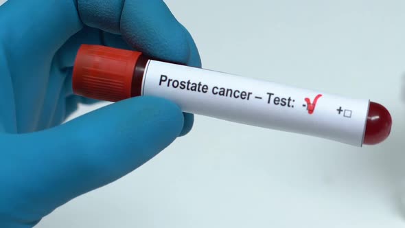 Prostate Cancer, Doctor Holding Blood Sample in Tube Close-Up, Health Check-Up