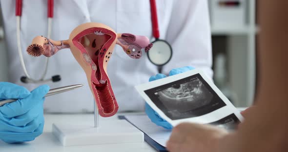 Gynecologist Demonstrates Model of Female Reproductive System to Young Woman in Clinic Closeup