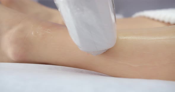 Laser Hair Removal Procedure, Close Up