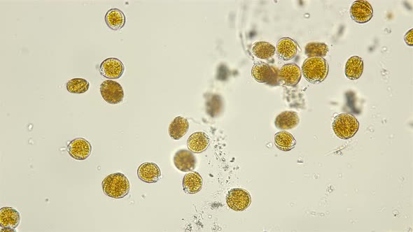  Colony of algae Dinoflagellata