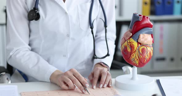 Doctor Cardiologist Examines the Patient Cardiogram in Clinic