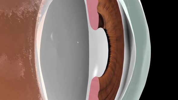 The anterior chamber is the front part of the eye between the cornea and the iris.