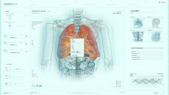 Interface of the futuristic cancer treatment software is examining the lungs alt