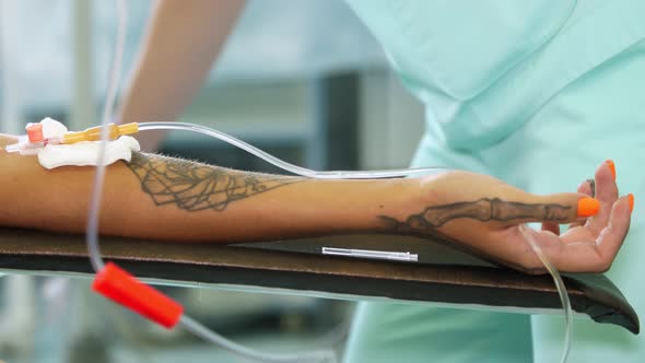 Close-up, a Peripheral Venous Catheter Is Installed on the Patient's Arm, Hand. Surgery. Anesthesia.