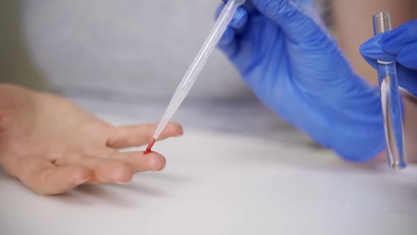 A Doctor in Blue Medical Gloves Takes a Blood Test From a Patient with a Pipette and Pours the