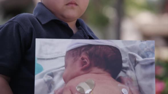 Latino boy holding his baby picture of his scars from surgeries.