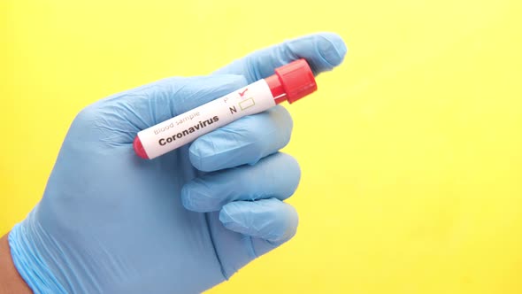 Hand in Blue Medical Gloves Holding Blood Test on Yellow