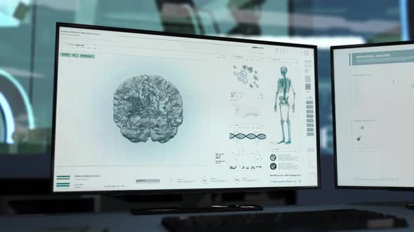 Advanced Computer Ct Scanning Software At Diagnostic Oncological Laboratory
