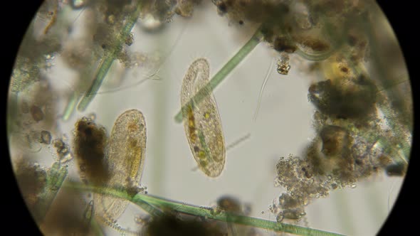 Infusoria Oxytricha Haematoplasma 