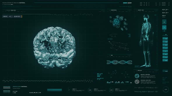 High Tech Diagnostic Interface Conducts Analysis Of Patients Brain Health