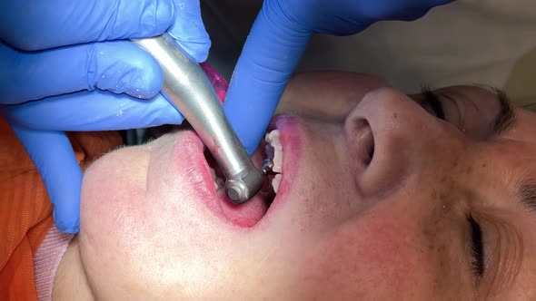 Woman Having Dental Treatment at Dentist's Office