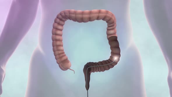 digestive system, colonoscopy animation hd