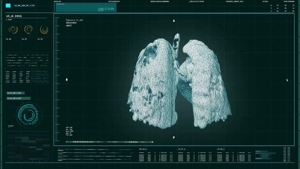 Identifying the Covid-19 Pneumonia Virus in the Structures of the Human Lungs