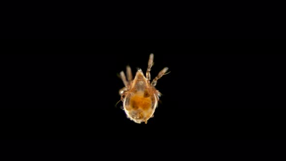 Mite Oribatida Under Microscope, Order Sarcoptiformes