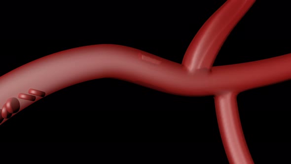 Animation Red Formation Thrombus Healthcare Medical