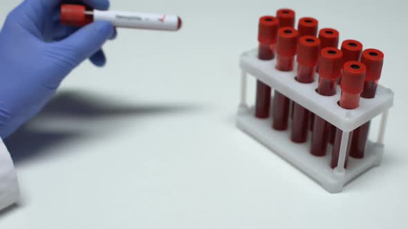 Positive Hemophilia Test, Doctor Showing Blood Sample in Tube, Health Checkup