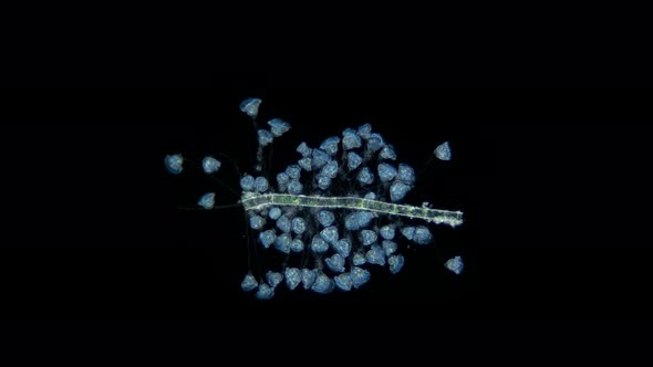 Infusoria Ciliophora Vorticella Under the Microscope Class Oligohymenophorea