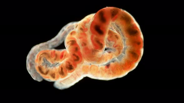 Tubifex Worm Under a microscope,Oligochaeta the Naididae Family, Type Annelida