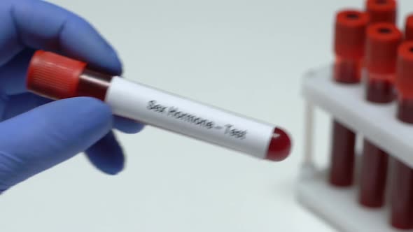 Sex Hormone-Test, Doctor Holding Blood Sample in Tube Close-Up, Health Check-Up