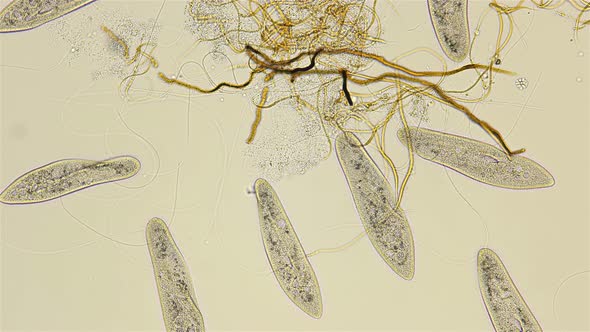 infusoria Paramécium caudátum under microscope, class Oligohymenophorea