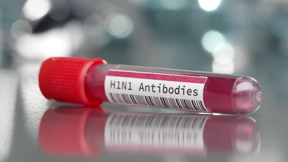 H1N1 antibodies vial in medical lab