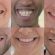 Collage of Smiling Mouth of People Looking at Camera - VideoHive Item for Sale