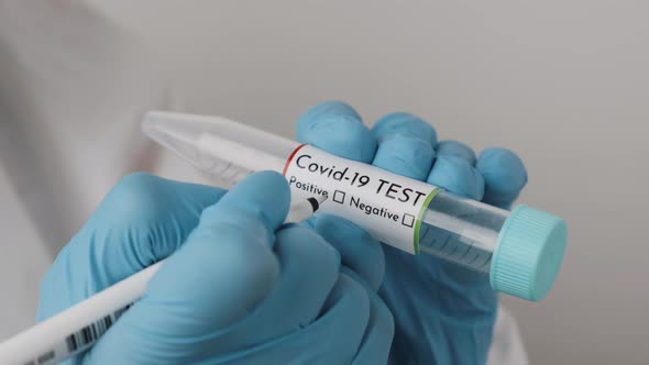 Laboratory Worker Filling a Positive Coronavirus on the Test Tube in Blue Rubber Gloves