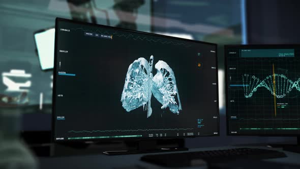 3D image of a lung CT scan on a computer screen. Covid-19 pneumonia. UI