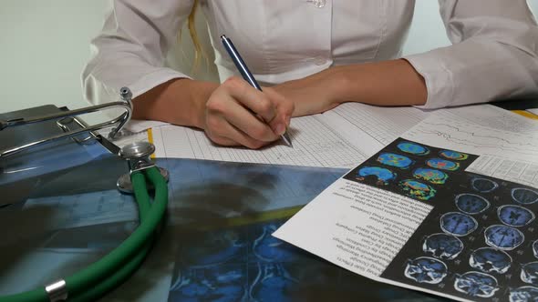 Female Doctor Working With Medical Charts