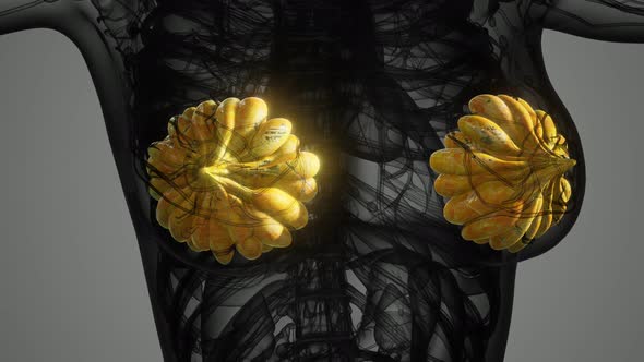 Medical Scan of Woman Breast Cancer alt