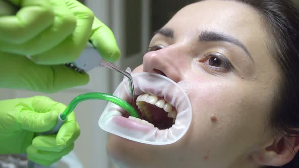 Young Woman with an Expander in Mouth at the Dental Clinic