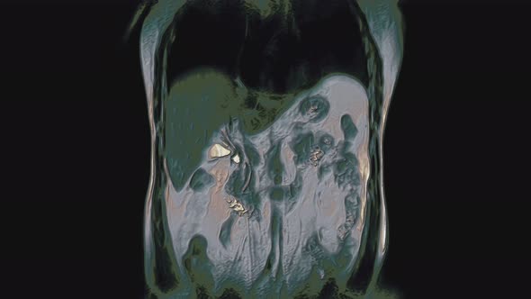 Bulk Multicolored CT Scan of the Abdomen