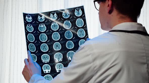 Doctor Examining Xray Magnetic Resonance Image of Head