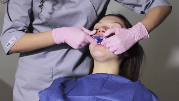 The orthodontist using dental impression tray on woman teeth