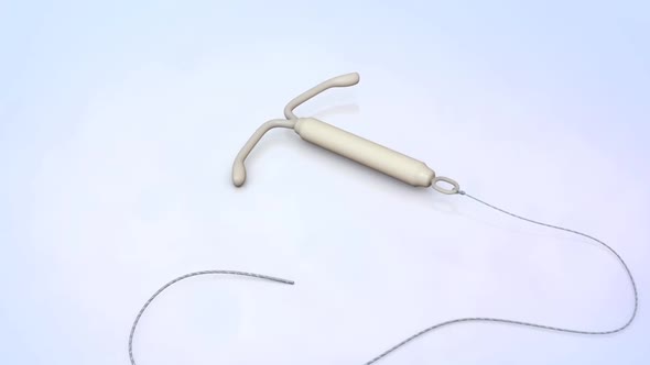 birth control device (IUD)