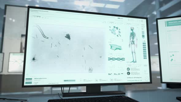 Innovative Microbiological Analysis Of Human Parasitic Helminth Worm Infection