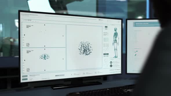 Futuristic Brain Scanner Software Interface Checks Patients Anatomy Data