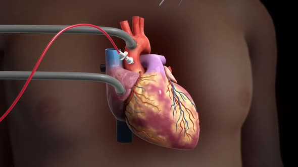 restarting the heart 3d animation