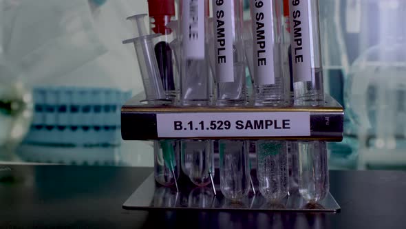 Samples named B.1.1.529 are being tested for a new Omicron variant of coronavirus in the laboratory.