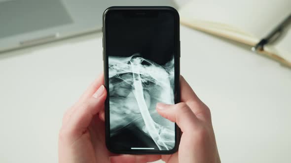 Doctor Veterinarian Examining Bird Skeleton Roentgen Closeup