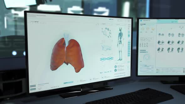 Patients Coronavirus Diagnosis Checked By X-ray Scanning System Software alt