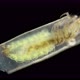 Trichoptera Larva Under a Microscope Family Hydroptilidae - VideoHive Item for Sale