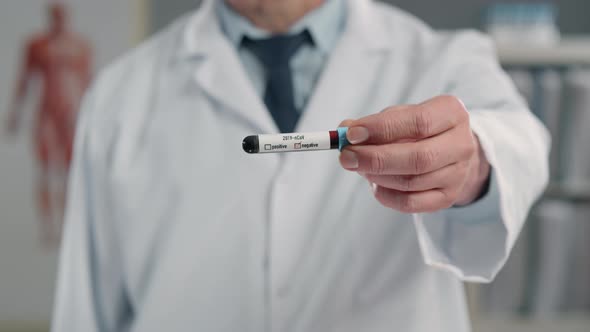 Doctor in White Coat Holding Negative Covid-19 Blood Sample Test Tube